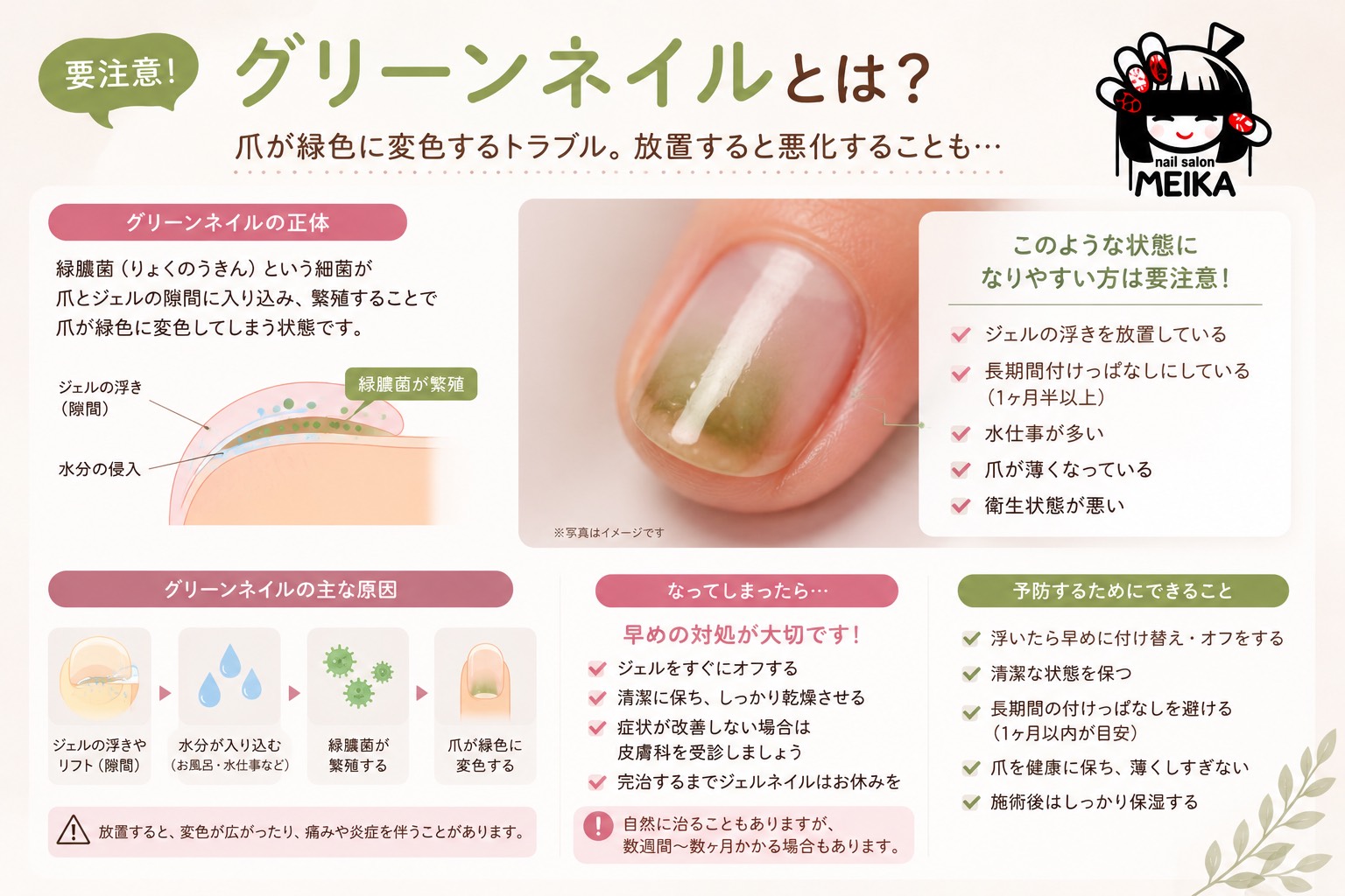 グリーンネイルとは?原因・対処・予防
